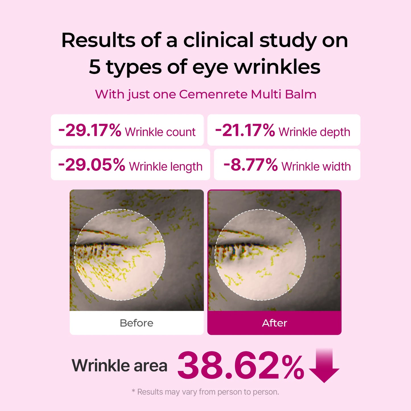 Advanced Anti-Aging Multi-Balm for Wrinkles & Firmness